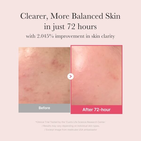 Medicube TXA + Niacinamide 15% Glow Facial Serum - Image 4