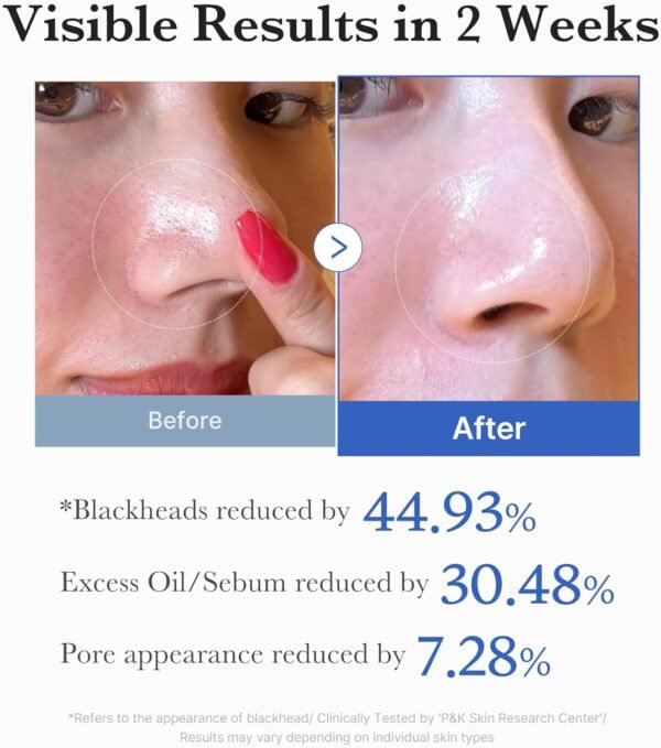 Medicube Zero Pore Pads - Image 4