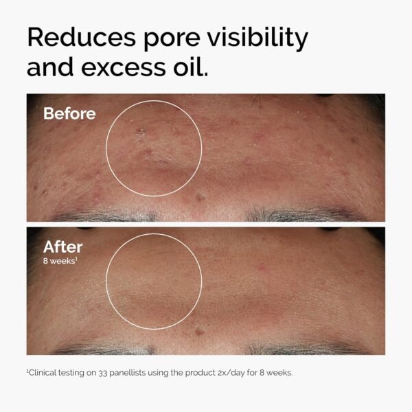 The Ordinary Niacinamide 10% + Zinc 1% - Image 4