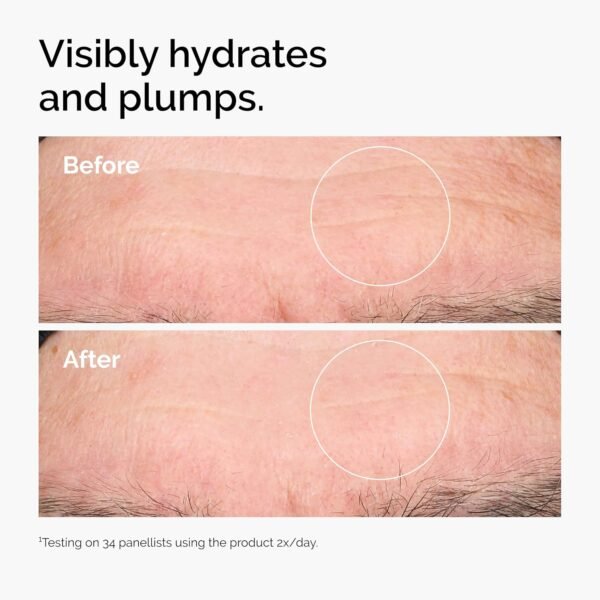 The Ordinary Hyaluronic Acid 2% + B5 - Image 4