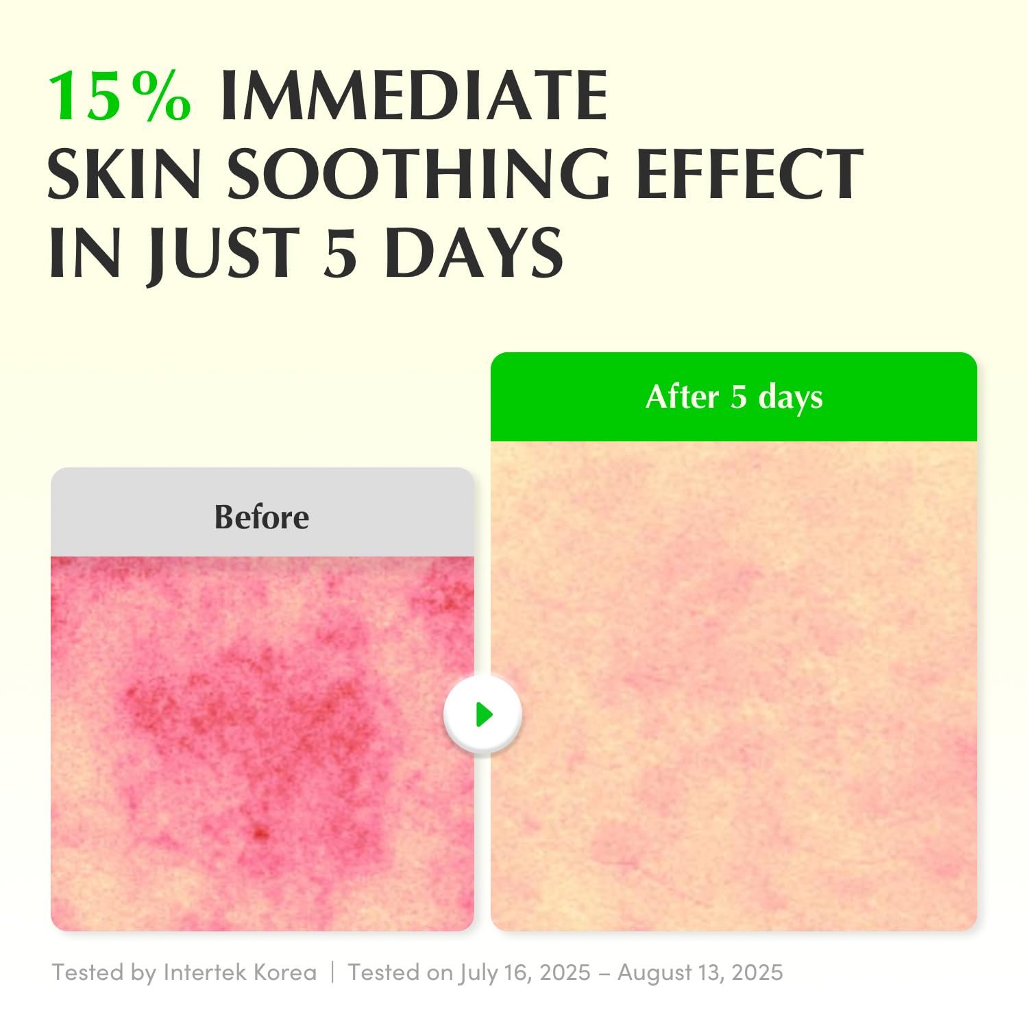 EQQUALBERRY - Aloe PDRN Calming Serum - Sérum apaisant à l'aloe vera et au PDRN - Image 4