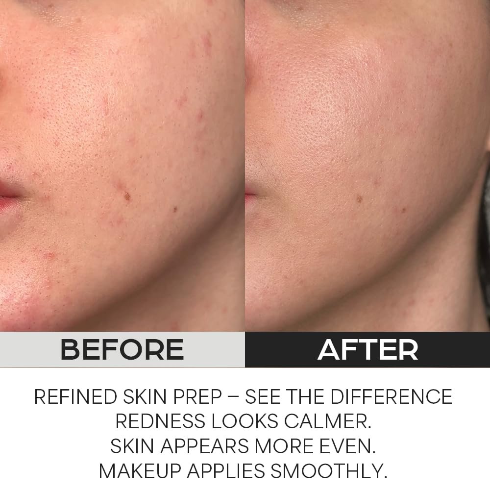 House of Hur - Clearing Skin Prep Essence Pad - Disques exfoliants - Image 2